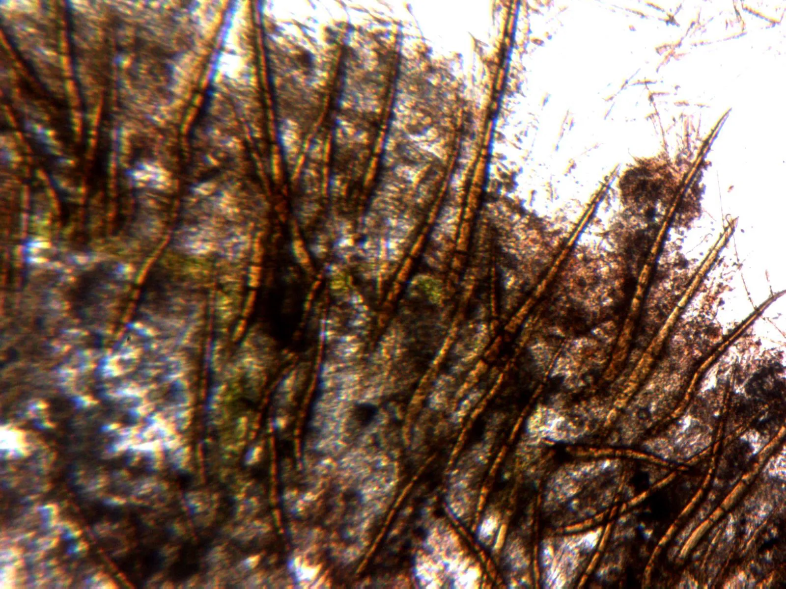 Microscopía de Scutellinia heterosculpturata - 11 - Pelos x 100